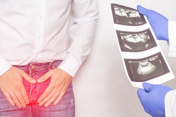 Conheca as doencas que podem afetar a prostata